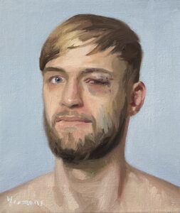Portrait of a man with black eye